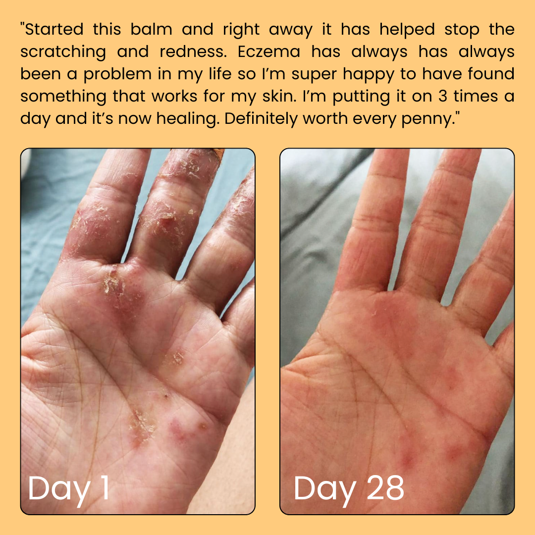 Advanced Skin Repair Balm