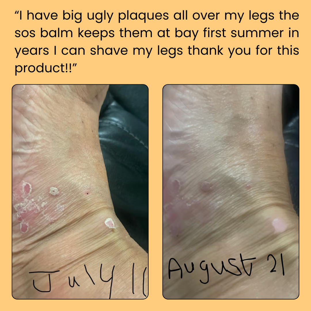 Advanced Skin Repair Balm