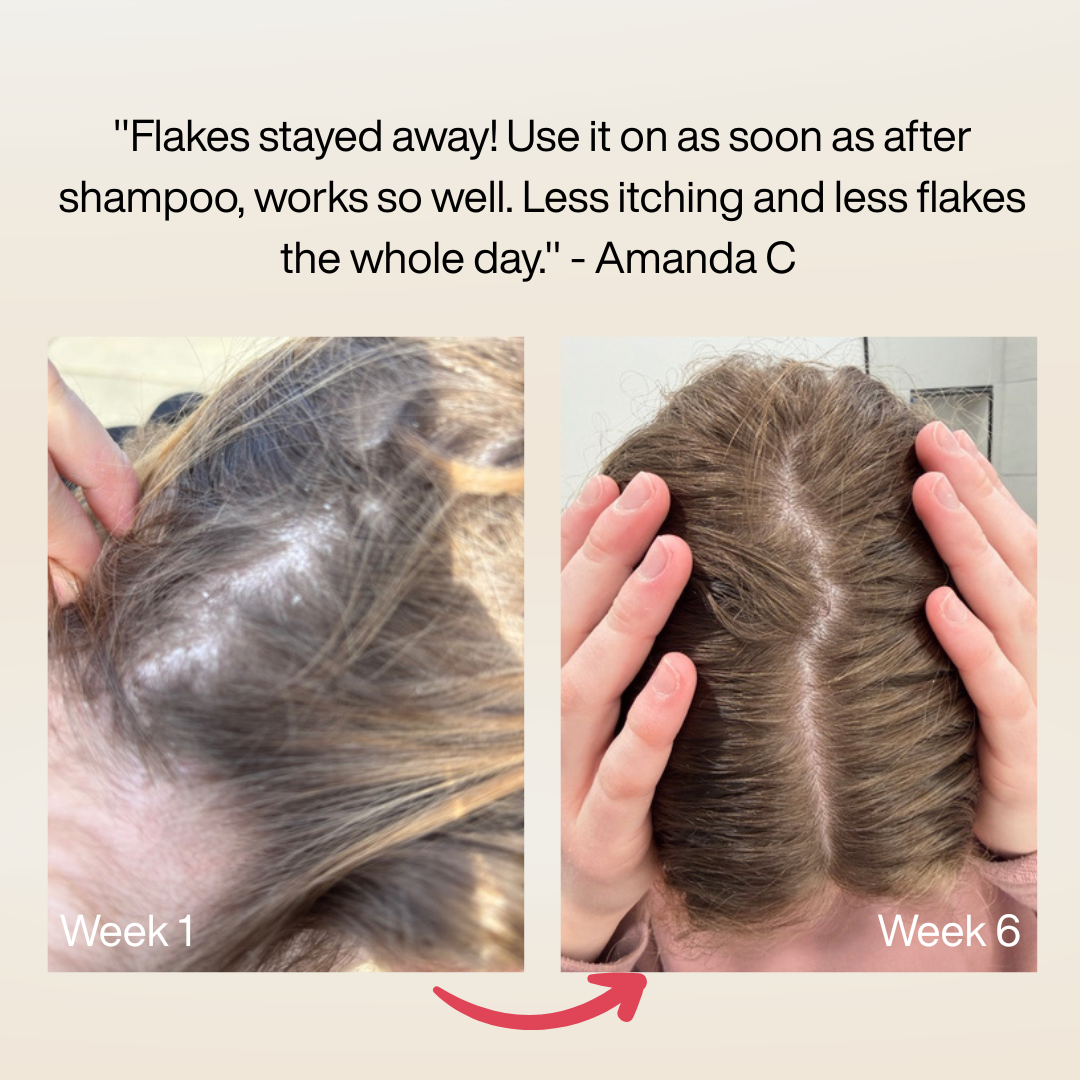 4th July - Scalp Serum
